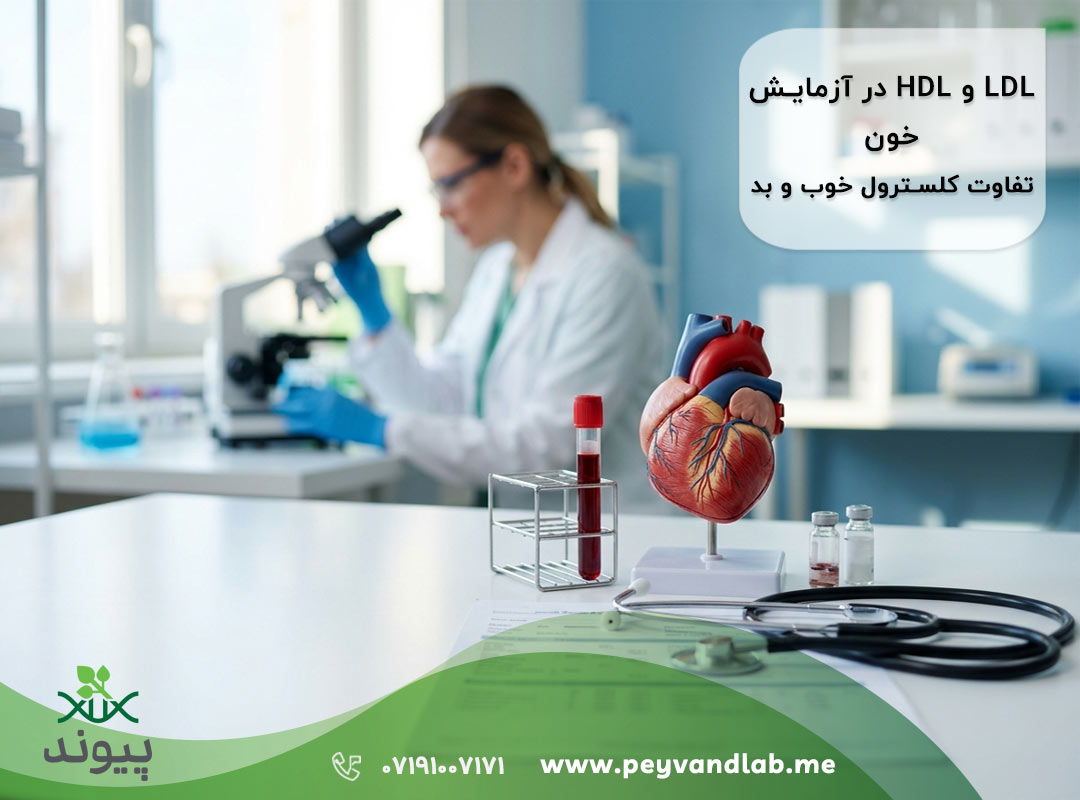 کلسترول LDL و HDL چیست؟ تفسیر کامل آزمایش چربی خون