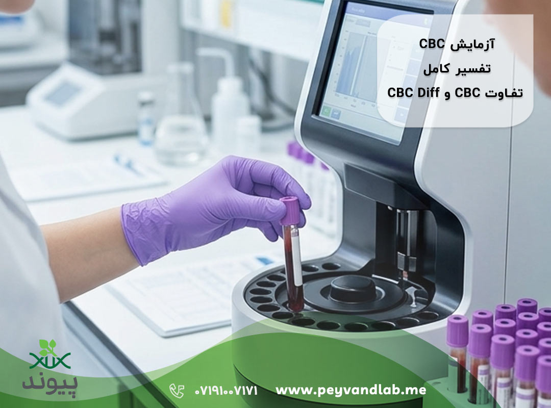 آزمایش CBC در شیراز | تفسیر کامل , تفاوت CBC و CBC Diff