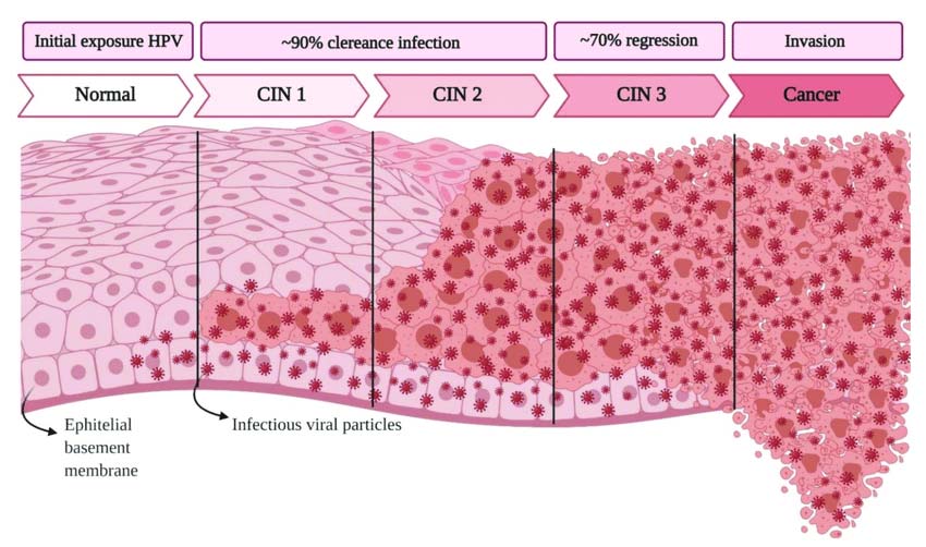 آشنایی با اساس Aptima HPV assay