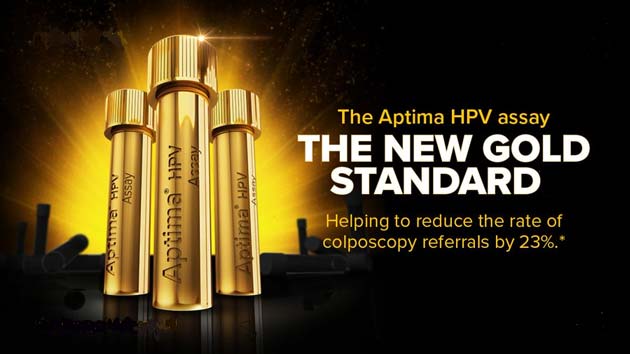 Aptima HPV assay