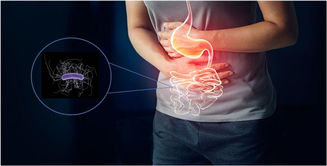 Clostridium difficle , Antigen , Stool