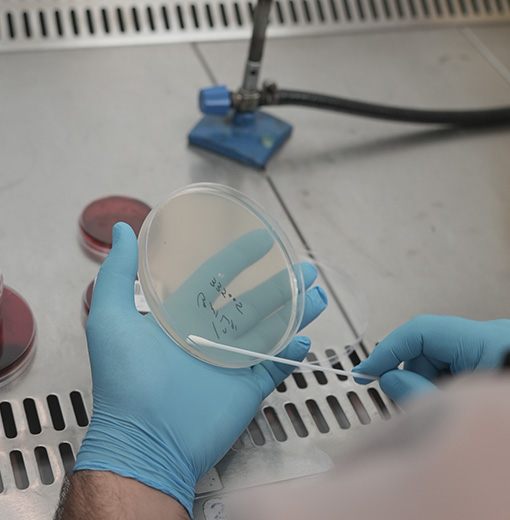 میکروبشناسی و آنالیز تجزیه ادرار